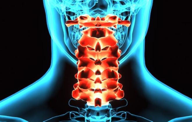 C-1 to C-7 vertebrae injuries are classified as cervical spinal cord injuries. 